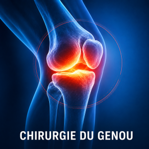 Chirurgie du genou