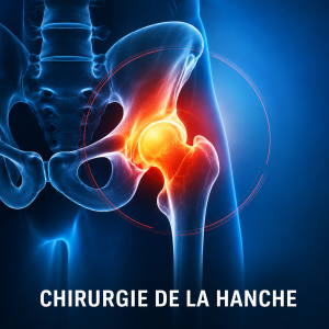 Chirurgie de la hanche